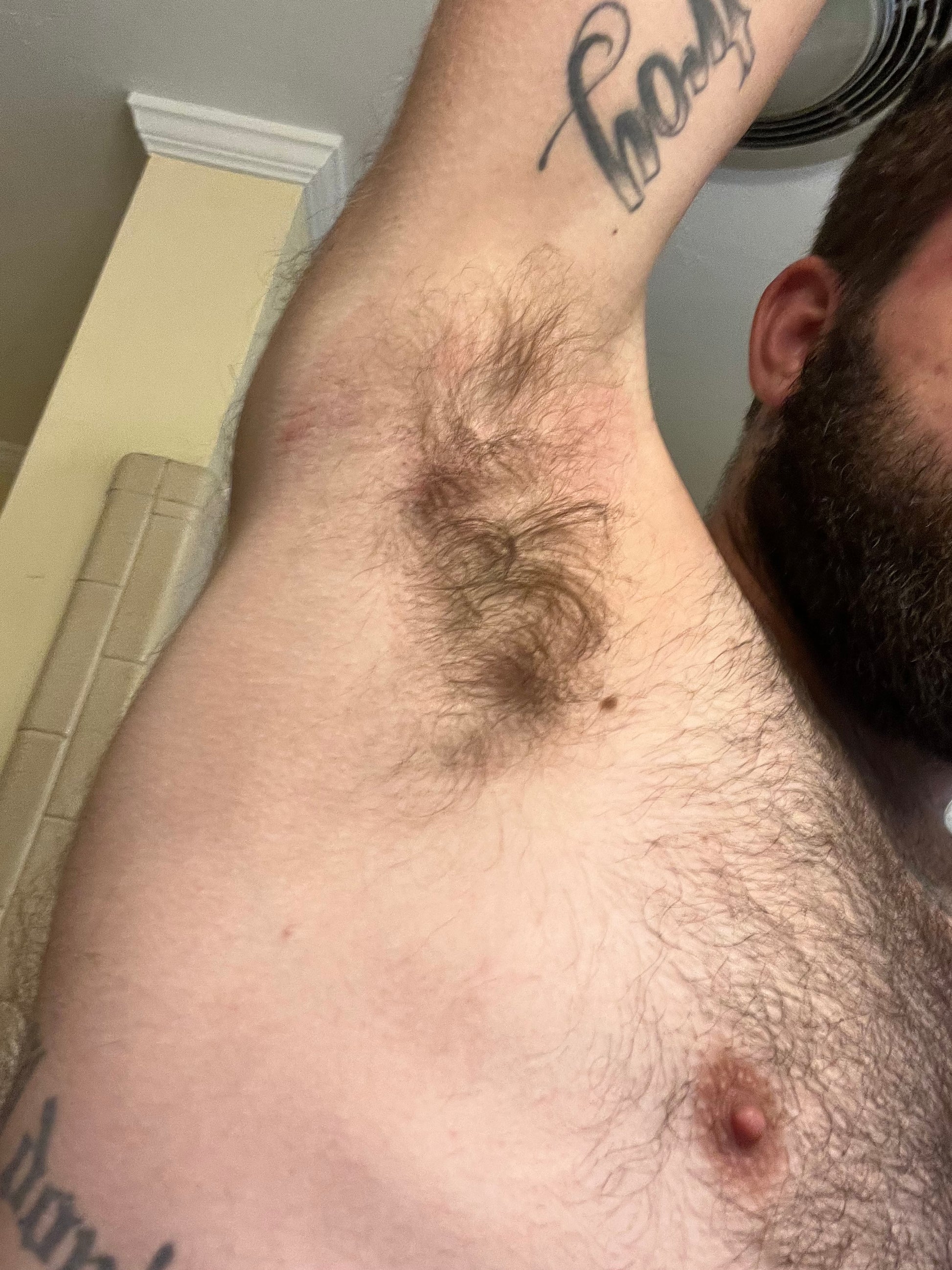 1 month after using cream